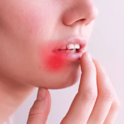 Cold Sore Scars: How Red Light Therapy Can Help Fade and Heal Them