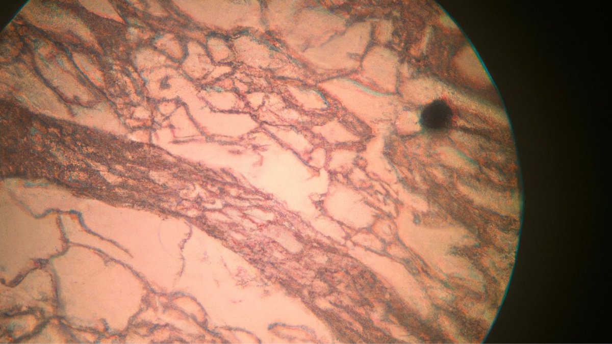 Unlocking Recovery: Photobiomodulation Therapy for Post-Exercise Recovery - Lumaflex