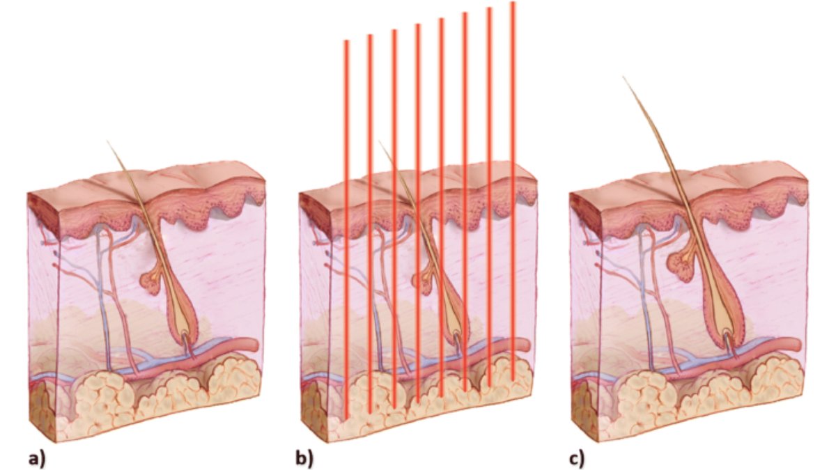 Red Light Therapy in Photodamage Repair - Lumaflex