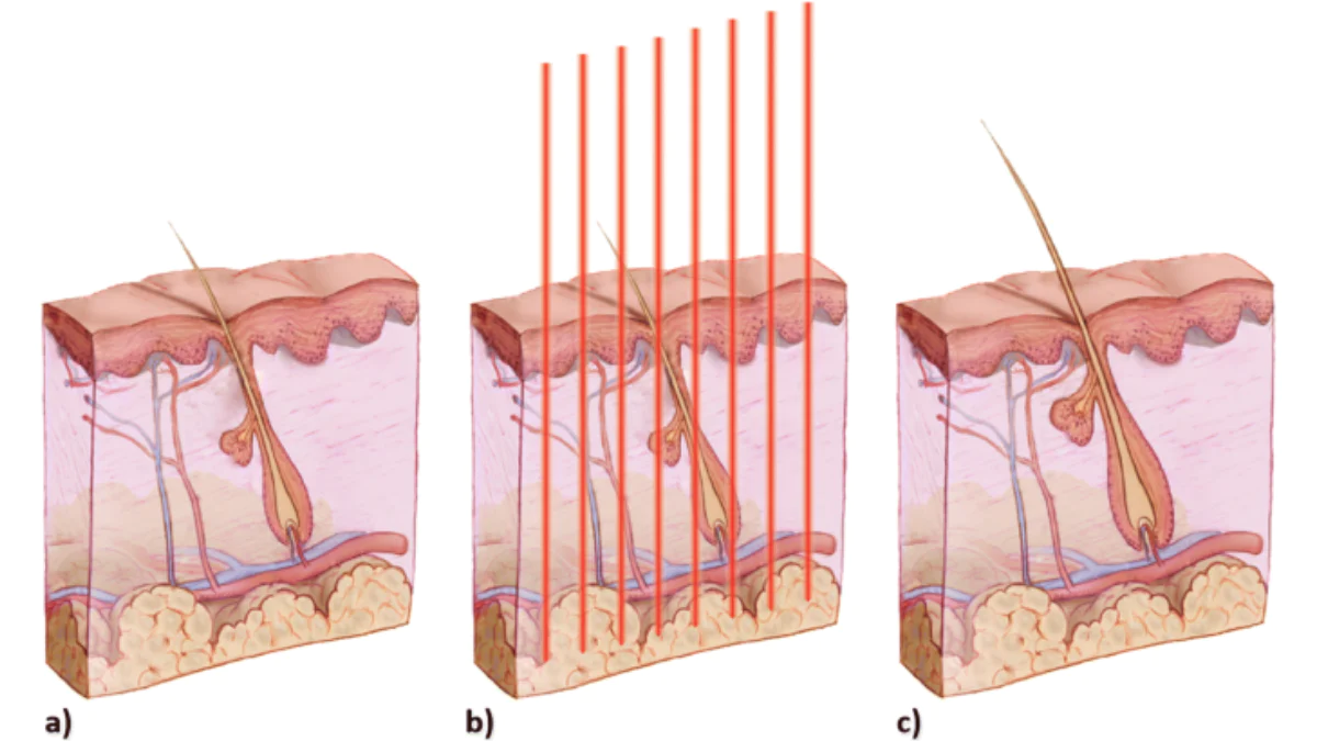 Red Light Therapy in Photodamage Repair