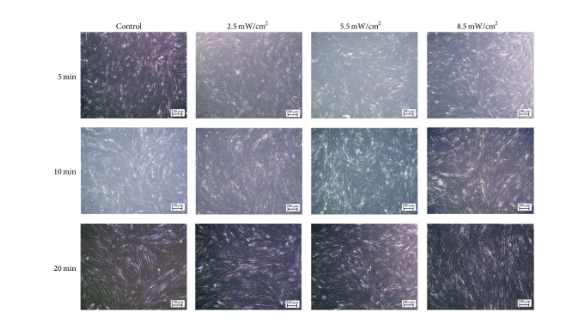 Empowering Healing: Photobiomodulation Therapy in Chronic Wound Care