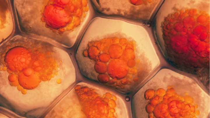 Photobiomodulation Therapy Reducing Adipose Tissue