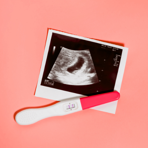 Discover the Benefits of Red Light Therapy for Pregnancy This Holiday Season - Lumaflex