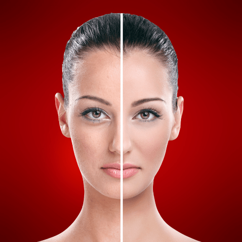 Transform Your Skin: Red Light Therapy Before and After - Lumaflex