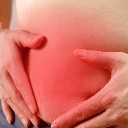 Does Red Light Therapy Help Stretch Marks? Benefits and Treatment Process - Lumaflex